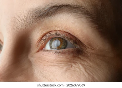 5 signs of cataract