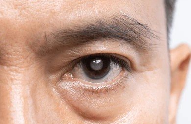 cataract treatment in bangalore