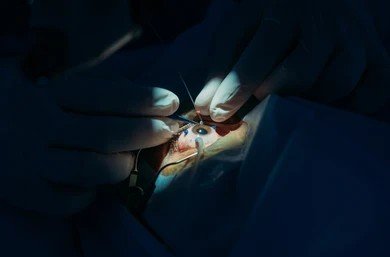 is lasik effective