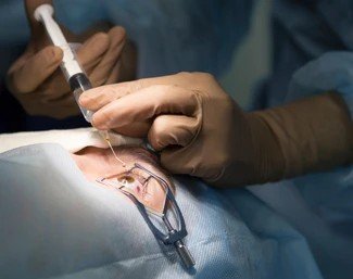 cataract treatment in bangalore