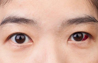 retina treatment in bangalore